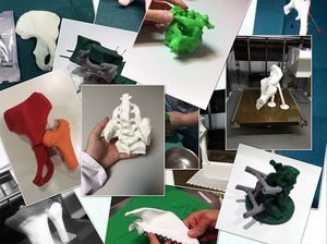 Modelos 3D de casos clínicos tratados en el centro.
