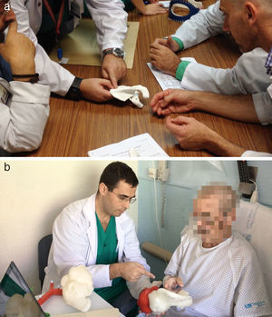 Modelos 3D como herramientas comunicativas. a) Fractura de escápula. Comunicación entre profesionales. b) Angiosarcoma pélvico. Comunicación médico-paciente.