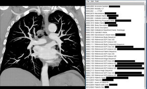Conventional CT image showing part of the metadata list containing the DICO image file header. As can be seen, it includes sensitive information and personal data that can be revealed by reading the file with appropriate software.
