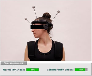 Image taken during the biomechanical functional assessment test of the cervical spine (above) and NI and CI results as shown in the report provided (below). The cut-off points established for NI and CI are 90% (between 90% and 100% is considered functional) and 50% (below 50% compatible with simulator pattern), respectively.