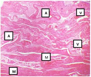 Histological slice of the myometrium (M) where arterial walls are identified (A) and venous walls (V) with no capillaries between them (H&E staining 4x).