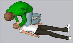 Dynamics and position of the victim and perpetrator in homicide by combination of chest compression, strangulation, and suffocation.