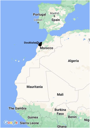 Map of the Doukkala region showing its borders.