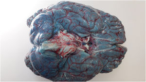 Base of the brain.