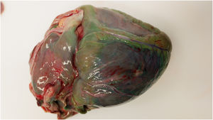 Posterior aspect of the heart.