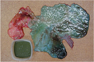 Turquoise coloration of the gastric mucosa, greenish gastric content in the vessel. (For interpretation of the references to colour in this figure legend, the reader is referred to the web version of this article.)