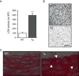 LOX transgenesis increases lysyl oxidase activity and induces the organisation of collagen fibres. (A) LOX activity measured in the supernatant of VSMC from mice transgenic for LOX (Tg) and control animals (WT). The results are expressed as mean±SEM (***: p<0.001 vs WT). (B) VSMC supernatants from Tg and WT mice were added on type I collagen gels and incubated at 37°C for 24h. A representative image is shown of the visualisation of those gels by confocal reflection microscopy. The images correspond to the maximum projection of a series in z (18 sections). Bar: 20μm. (C) Representative image of Sirius red staining of carotid arteries from the above animals visualised under polarised light. The arrows indicate red birefringent regions corresponding to coarse and compact collagen fibres (i.e. mature collagen).