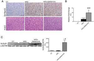 PPARβ/δ activators increase VLDLR abundance in liver. Male mice were fed a standard chow or HFD with or without GW501516 (3mgkg−1day−1). Animals were sacrificed after three weeks of treatment. (A) Oil Red O and hematoxylin–eosin (H&E) staining of livers. Scale bar: 100μm. (B) Quantification of ORO staining of Fig. 1A. Data are presented as the mean±S.D. (n=4 per group). (C) Liver cell lysates were assayed for Western blot analysis with antibody against VLDLR. *p<0.05 vs. WT mice fed a standard diet (CT). #p<0.05 vs. mice fed a HFD. Data are presented as the mean±S.D. (n=5 per group) relative to the control (CT) group. ***p<0.001 and *p<0.05 vs. CT group. ###p<0.001 and #p<0.05 vs. mice fed the HFD.