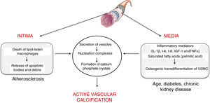 Mechanisms involved in active calcification at the level of the intima (typical of atherosclerotic lesions) and the media (commonly associated with age, diabetes and chronic kidney failure). VSMC: vascular smooth muscle cells.