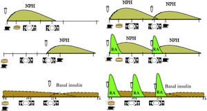 Carbohydrate distribution over 24 h based on the guideline and insulin action profile. Basal insulin: glargine U100, glargine U300, degludec, detemir; NPH: neutral protamine Hagedorn; RA: rapid-acting insulin analogue.