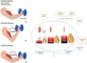 Types of muscle contractions and their association with exercise modalities. Isometric resistance exercise is a type of strength training involving isometric contractions (a), during which muscle tension increases while muscle length remains relatively constant and limb movement is not produced. Concentric (b) and eccentric(c) muscle contractions (associated with muscle fiber shortening and lengthening, respectively) occur during dynamic resistance training, aerobic exercise, and combined forms of training. These contractions are isotonic (tension within the muscle remains constant) and result in limb movement. The strength trained increase the muscular mass and reestablish the inflammatory/anti-inflammatory equilibrium.