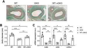The presence of FcγR activators in macrophages aggravates elastase-induced AAA development in mice. Representative images (scale bars, 100 μm) of Masson’s trichrome staining (A) and aortic diameter measurement (B) in abdominal aortic sections from wildtype (WT), γ-chain-deficient (GKO), and WT macrophage adoptive transfer (WT→GKO) mice 14 days after elastase aortic perfusion. (C) qPCR analysis of mRNA expression of activating FcγR isoforms. Data normalised by 18S rRNA and expressed in arbitrary units (a.u.). Individual values and mean ± SD of 4–5 mice per group.