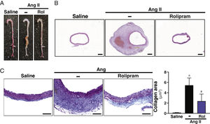 Rolipram treatment attenuates AAA formation in Ang II-infused ApoE−/− mice. ApoE−/− mice were infused with saline or Ang II (1000 ng/kg/min) for 28 days and treated or not with rolipram (Rol; 3 mg/kg/day; i.p.). (A) Macroscopic images of aortas from each of the experimental groups. (B) Representative images of haematoxylin-eosin staining of sample sections from the groups indicated in A (Bars: 200 μm). (C) Representative images of Mason