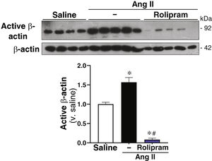 Rolipram attenuates canonical Wnt pathway activation in Ang II-infused ApoE−/− mice. ApoE−/− mice were infused with saline or Ang II (1,000 ng/kg/min) for 28 days and treated or not with rolipram (Rol; 3 mg/kg/day; i.p.). Representative images of Western blot analysis corresponding to the levels of active β-catenin in each experimental group are shown. Levels of β-actin are shown as loading control. The histogram corresponds to the quantification of the level of active β-catenin in each experimental group. Results are shown as mean ± SEM. p < .001: * vs. saline; # vs. Ang II alone. (saline, n = 4; Ang II, n = 5; rolipram, n = 5).
