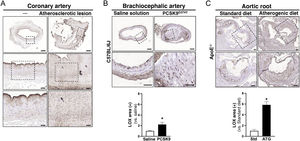 LOX is increase in human atherosclerotic lesions and in murine models. (A) Images representative of the immunohistochemical analyses for LOX in healthy human coronary arteries (left) and those with atherosclerotic lesion (right). The lower panels belong to the magnification of the areas indicated in the upper panels. Bars: 500 μm (upper panel), 100 μm (middle panel), and 50 μm (lower panel). (B) LOX expression analysed by immunohistochemistry and quantitative analysis of the immunostaining of brachiocephalic arteries of mice C57BL/6J in whom atherosclerosis was induced by means of transduction with PCSK9D374Y and atherogenic diet, as well as the arteries with no lesion belonging to animals who received saline solution (saline solution n = 5, PCSK9 n = 8). Bars: 100 μm (upper panel) and 50 μm (lower panel). (C) Representative images and quantification of the immunohistochemical analyses for LOX in the aortic roots of ApoE–/– animals fed a standard diet (Std) and an atherogenic diet (ATG) for 12 weeks (n = 4). The lower images exhibit the magnification of the areas indicated in the upper panels. The results are expressed as the mean ± SME. *p < 0.01 vs. saline s. or Std. diet. Bars: 100 μm.