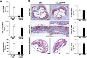 Impact of induction with PCSK9D374Y together with an atherosclerotic diet on PCSK9 plasma levels and circulating lipids and the development of atherosclerotic lesions in mice. The TgLOXVSMC mice (black bars) and control (WT; white bars) received a single injection of AAV-PCSK9D374Y and were fed an atherogenic diet for 20 weeks. (A) Plasma levels of the human PCSK9 protein (hPCSK9) and total cholesterol and triglycerides at the beginning (0 weeks) and end (20 weeks) of the experimental procedure. The results are expressed as the mean ± SME (n = 15). * p < 0.0001 vs. t = 0. (B) Representative images of Oil Red O (ORO) staining and its quantification in sections of aortic roots (upper panel, n = 15), aortic arch (middle panel, n = 7), and brachiocephalic artery (upper panel, n = 7–9) of each experimental group after 20 weeks of study. The results are expressed as the mean ± SME.