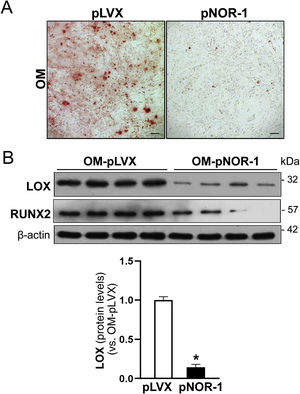 The effect of NOR-1 overexpression in valvular interstitial cells (VICs) on calcification and LOX expression. Valvular interstitial cells (VICs) were transduced with a lentiviral vector to overexpression NOR-1 (pLVX/NOR-1, pNOR-1) or with the empty lentiviral vector (pLVX) and incubated in an osteogenic medium (OM). (A) Representative images of the Alizarin Red staining in VICs transduced with pNOR-1 or pLVX and exposed to OM. Bars: 100 μm. (B) Representative images of the Western Blot analysis of LOX and RUNX2 protein levels in these cells. The bar graph illustrates the densitometric quantification of the levels of LOX in the cells transduced with pLVX (white bars) and pNOR-1 (black bars). The results are expressed as the mean ± SME (n = 4). *p < 0.05 vs. VICs transduced with pLVX exposed to OM.