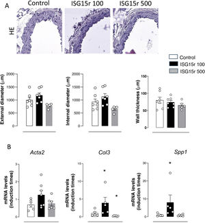 Effect of recombinant ISG15 (ISG15r) on aortic vascular structure. (A) Representative images (objective ×10 and zoom 1) and quantification of the diameter and wall thickness of aortic cross-sections and (B) aortic expression levels of mRNA of contractile (Acta2), synthetic (Col3), and calcification (Spp1) phenotype markers in control mice and mice infused with ISG15r at doses of 100 and 500ng/day for 14 days. The number of samples is represented by the number of dots and represents different animals. *p<0.05 vs. ISG15+/+ by unpaired t-test.