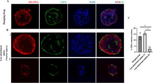 Cellular structure of inverted blood vessel from spheroids in hanging drop and in low-attachment plate. A) Representative immunofluorescence images of HUVEC-HUASMC spheroids in hanging drop and in low-attachment plate B) both sizes; larger (1) and smaller (2). The endothelial markers CD31 (green), vascular smooth muscle cell α-SMA (red), as well as nuclear staining (DAPI) are observed. MERGE, all channels together. C) Quantification of the percentage of CD31+ cells in the total number of cells in the spheroid core. Scale bars 50 μm. n = 3 spheroids per condition. t-Student. **P < .01. The colour of the figures can only be seen in the electronic version of the article.