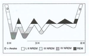 Adult sleep hypnogram. Source: Nicolás et al.9