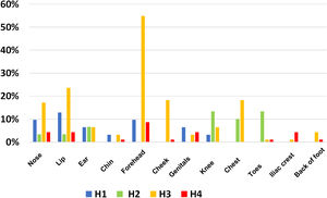 Site and frequency of PUs in the different hospitals.