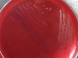 Appearance of the colonies in blood agar after 24h of incubation.
