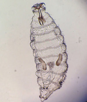 First-stage Oestrus ovis larva 10× under examination with a microscope.