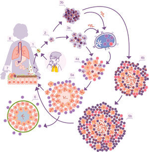 Infectious cycle of M. tuberculosis. 1. Entry of bacilli into the pulmonary alveolus through an aerosol drop. 2. Phagocytosis by an alveolar macrophage (AM) and subsequent multiplication inside. 3. Destruction of the AM, local dissemination of M. tuberculosis, phagocytosis by other AMs, and generation of a local inflammatory response dominated by monocytes (3a) or PMN cells (3b), thanks to which the bacilli can be drained into the regional lymph node, where Th1 or Th17 lymphocytes proliferate. 4. The lymphocytes are attracted by the inflammatory response of the lesions and activate the infected AMs or attract more PMN cells, depending on whether the immune response is Th1 (4a) or Th17 (4b), respectively. In the first case, there is a control of the bacillary population and the dormant bacilli are drained through the foam macrophages (5a) until it is controlled by encapsulation of the lesion (6). In the second, the lesions continue growing in size thanks to the entry of PMN cells and the extracellular bacillary growth in the NET, generating new peripheral lesions. In this case, the bacillary concentration is much higher and from here the drainage is much more significant, whether through the alveolar fluid or on a systemic level through neovascularisation of the granuloma (5b). In the lungs, the bacilli in the alveolar fluid (7) tend to be drained into the gastrointestinal tract (8), although they may form part of new aerosols, generating new lesions (1).