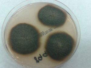 Dark cotton-like colonies in Sabouraud-dextrose agar medium after 10 days of incubation at 86°F.