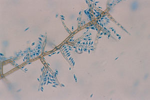Microscopic analysis with lactophenol blue solution (×400). Conidiogenous cells with funnel-shaped collarets, and cylindrical conidia.