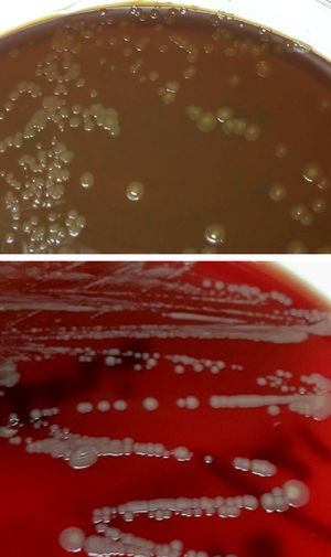 Gram-negative coccobacilli colonies grown on chocolate agar media and blood agar from palmar abscess drainage following cat bite. Growth of opaque, brownish-yellow, convex, shiny and creamy-looking colonies can be seen in these media.