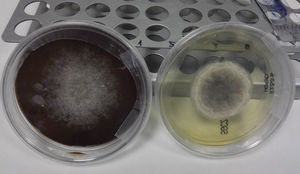 Agar (left) and Sabouraud agar (right) cultures reverse showing gray-black colonies of Scedosporium apiospermum.