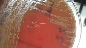 Aspect of greyish colonies of Actinomyces turicensis in anaerobic blood agar.