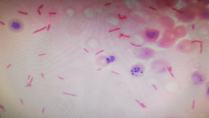Gram-negative rods in palisade in smear from blood culture.