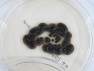 Olive-black colonies isolated on Sabouraud dextrose agar at 7 days.