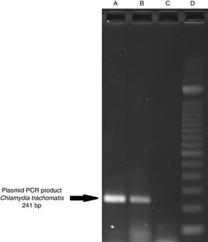 Detection of the cryptic plasmids of C. trachomatis in an endocervical sample. The image shows: Well (A) amplification with product of 241bp of the positive control (plasmid DNA from C. trachomatis ATCC® VR-902B), Well (B) PCR product of the clinical sample, Well (C) negative control (HeLa cell DNA), and Well (D) a 100bp DNA ladder (Invitrogen, CA, USA).