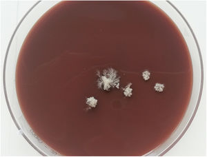 Cerebriform colonies of T. verrucosum in chocolate agar after 10 days of incubation at 37°C.