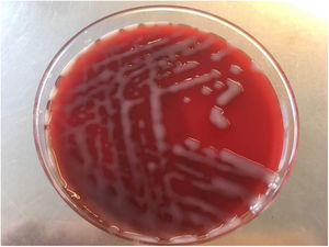 Blood agar culture of Klebsiella pneumoniae subsp. rhinoscleromatis.