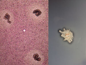 Granules in the direct examination (Lugol, ×40). Culture in casein medium which identifies Nocardia brasiliensis.