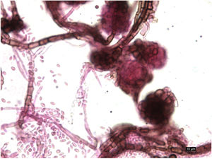 Microscopic view (staining with lacto-fuchsin, ×400). Septate hyphae and pycnidia with conidia inside.