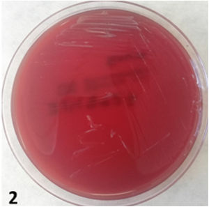 Growth of Brucella spp. on Columbia blood agar+5% sheep blood.