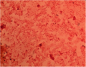 Gram stain of blood culture with numerous Gram-negative bacilli.