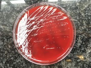 Growth of Nocardia brasiliensis of patient samples on blood agar plate.