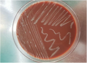 Growth of Mycobacterium abscessus subsp. massiliense in chocolate agar.