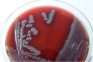 P. monteilii colonies cultured on Columbia agar under aerobic conditions for 24 h. Colonies are white, shiny and mucoid.