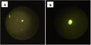 Optical microscopy (A) Remains of protoscolices. (B) Scolex.