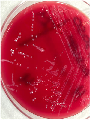 Alistipes finegoldii in pure culture on blood agar in anaerobiosis. Typical raised, circular, opaque colonies can be observed.