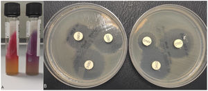 Identification of Shigella spp. and detection of the presence of an extended-spectrum beta-lactamase (ESBL). (A) Left: TSI (triple sugar-iron) medium, glucose fermentation can be seen but not producing gas; right: LIA (lysine-iron agar) medium, there is no decarboxylation or deamination of the lysine. (B) Disc-diffusion technique with the confirmation kits "Total ESBL, AmpC and ESBL+AmpC Confirm kit" (ROSCO Diagnostica A/S, Taastrup, Denmark). The increase in the cefotaxime and ceftazidime halo (>5mm) can be seen in the presence of clavulanic acid but not in cloxacillin, confirming the presence of ESBL.