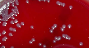 E. anophelis colonies on blood agar.