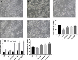 Saponins improved cell morphology and viability and increased insulin secretion. INS-1 cells were treated with or without saponins for 24h. (A) Morphology of cells in different groups under an inverted microscope (20×). Note: a, NC group; b, HG group; c, HG+S (80μg/ml) group; d, HG+S (160μg/ml) group; e, HG+S (320μg/ml) group. (B) Cell viability in different groups measured by CCK8 assay. The unit of saponins is μg/ml, all of the following are in this unit. (C) Effects of saponins on GSIS and intracellular insulin content in cells from different groups. Note: BIS represents basal insulin secretion, GSIS represents glucose-stimulated insulin secretion. Data are shown as the mean±SD of at least three independent experiments. Differences between two groups were compared using t-tests or ANOVA. *P<0.05 compared with the control group; #P<0.05 compared with the HG group.